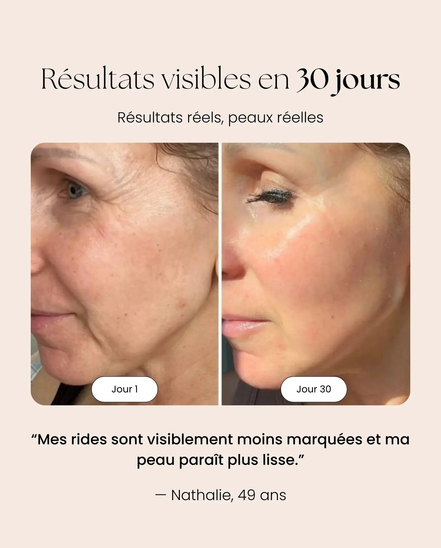 Masque LED NOCTEA Anti-Âge | Peau plus lisse en 10 min par jour NOCTEA