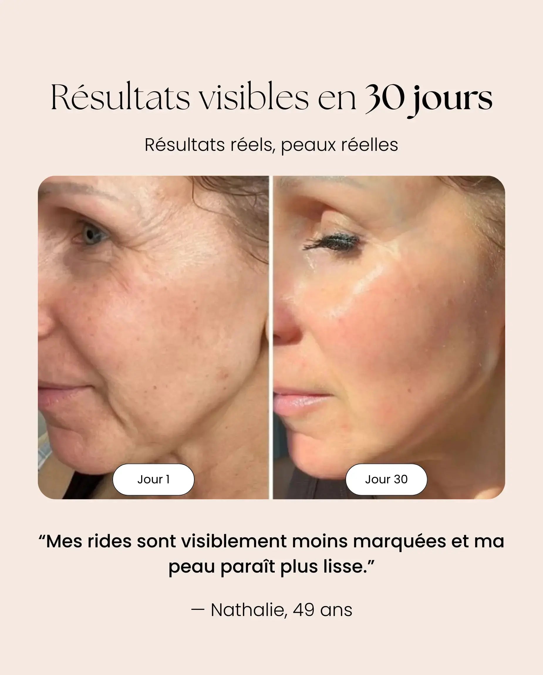 Masque LED NOCTEA Anti-Âge | Peau plus lisse en 10 min par jour NOCTEA