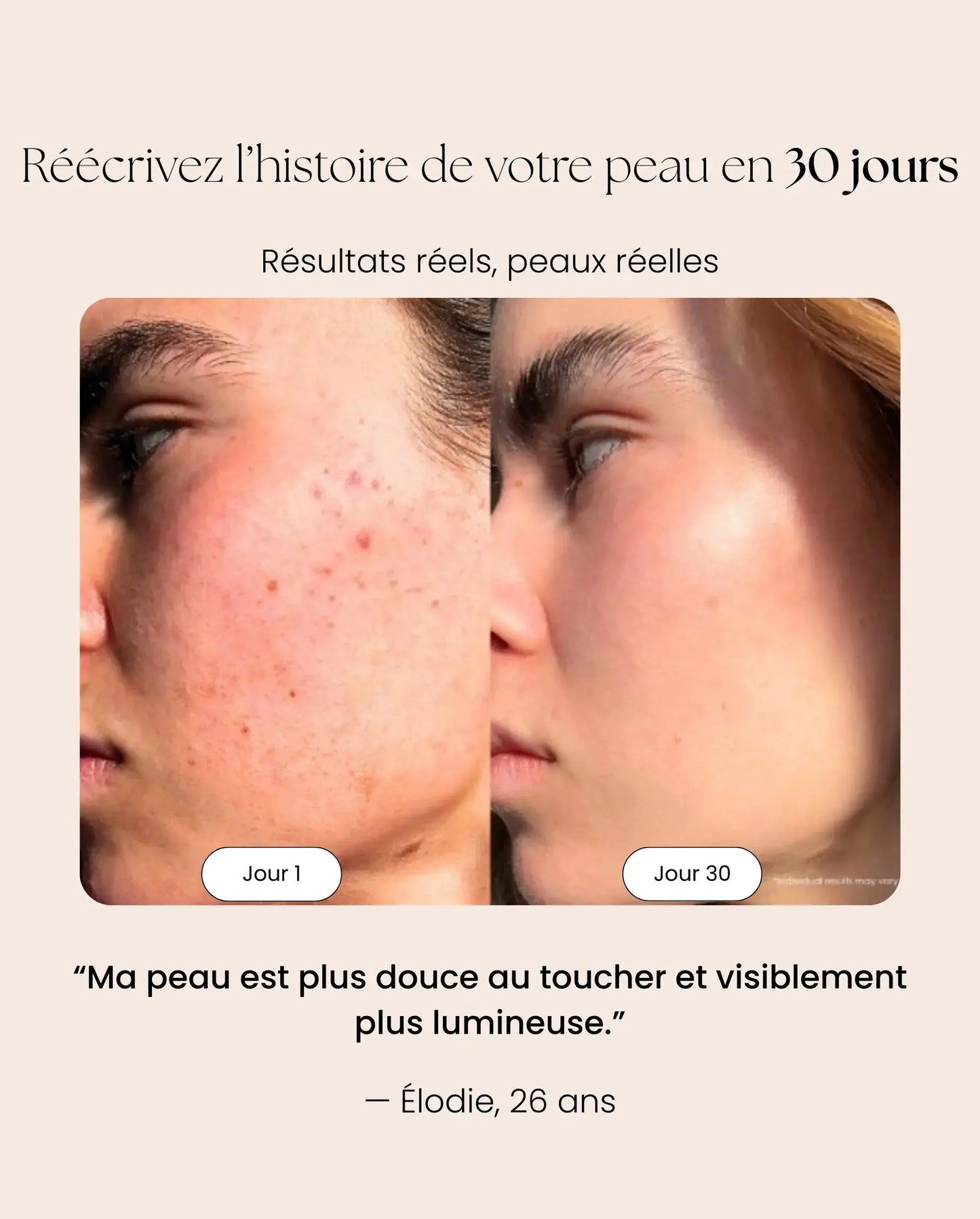 Masque LED NOCTEA Anti-Âge | Peau plus lisse en 10 min par jour NOCTEA