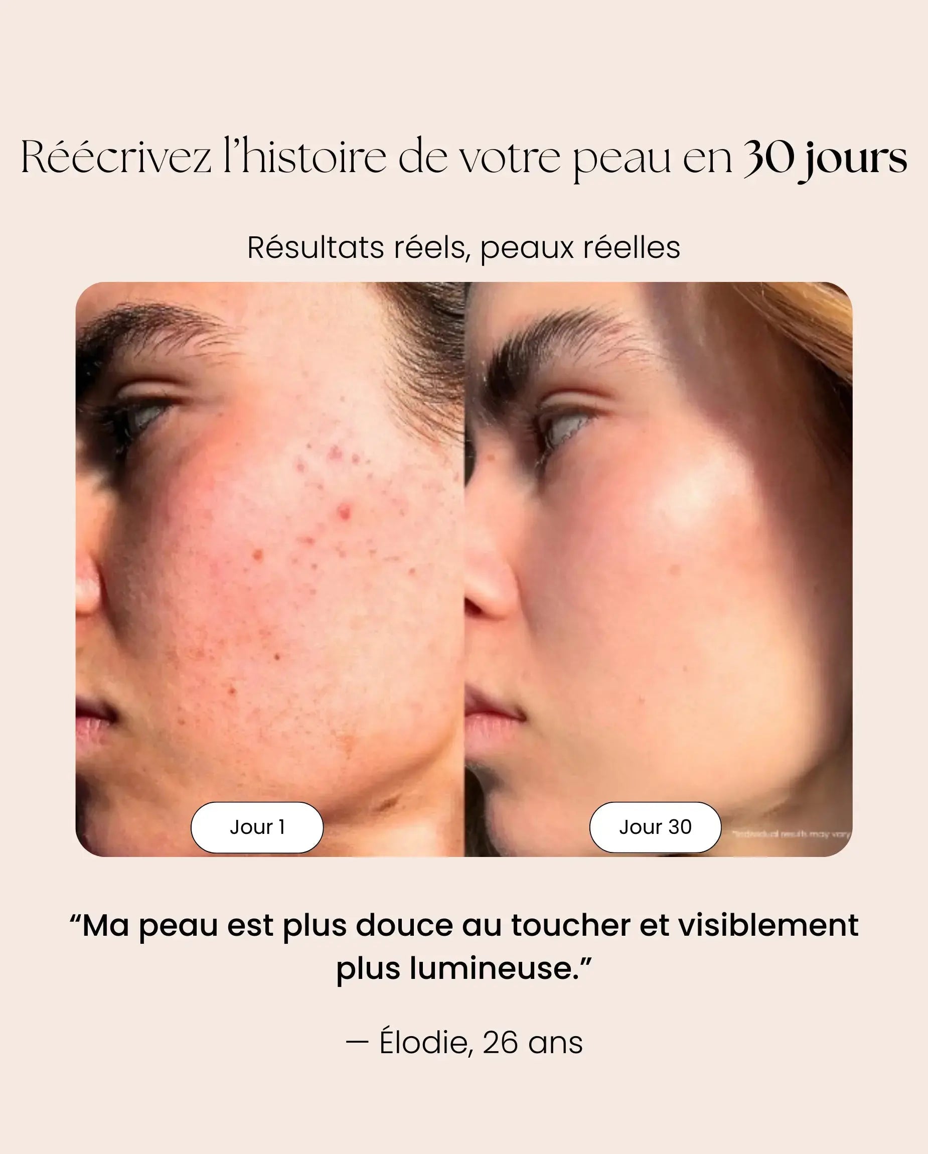 Masque LED NOCTEA Anti-Âge | Peau plus lisse en 10 min par jour NOCTEA