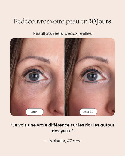 Masque LED Pro NOCTEA | Technologie Anti-Âge NOCTEA